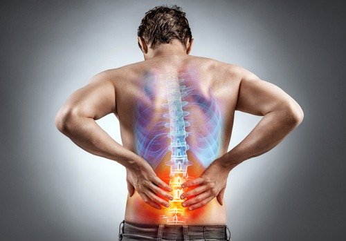 Lower back pain disability