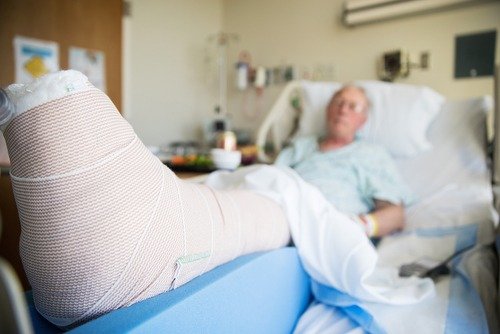 Factors can make fall injuries more severe