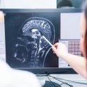 Characteristics of a brain injury