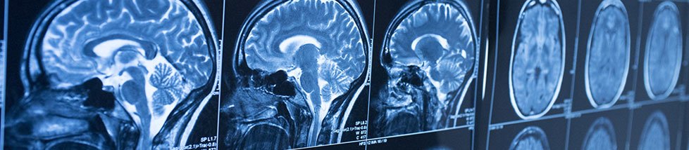 Brain Injuries Attorneys In Knoxville And Across the US
